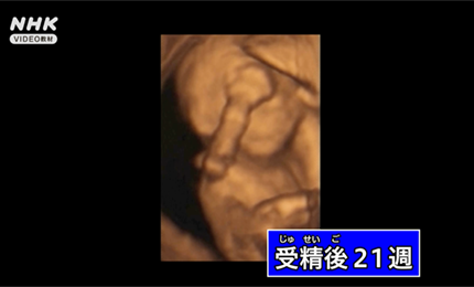 子宮の中のようす
